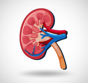 Kidney infection